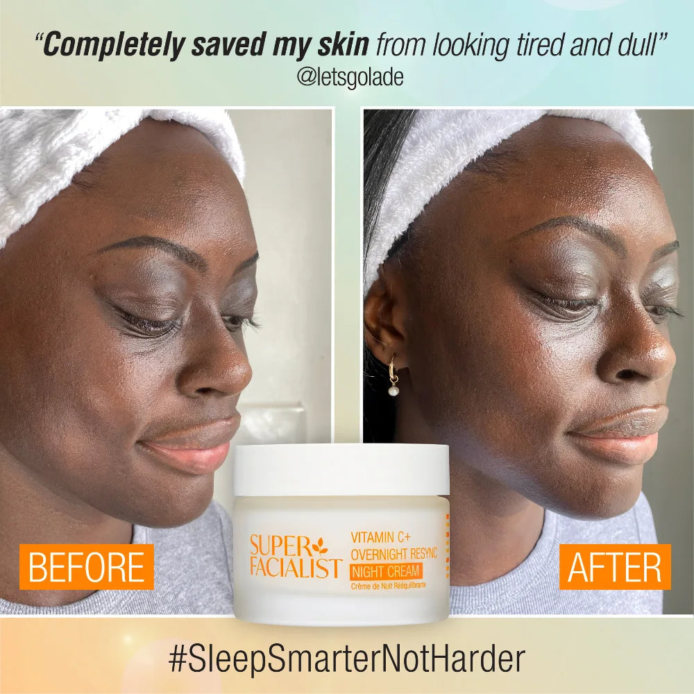 Vitamin C Night Cream before and after 